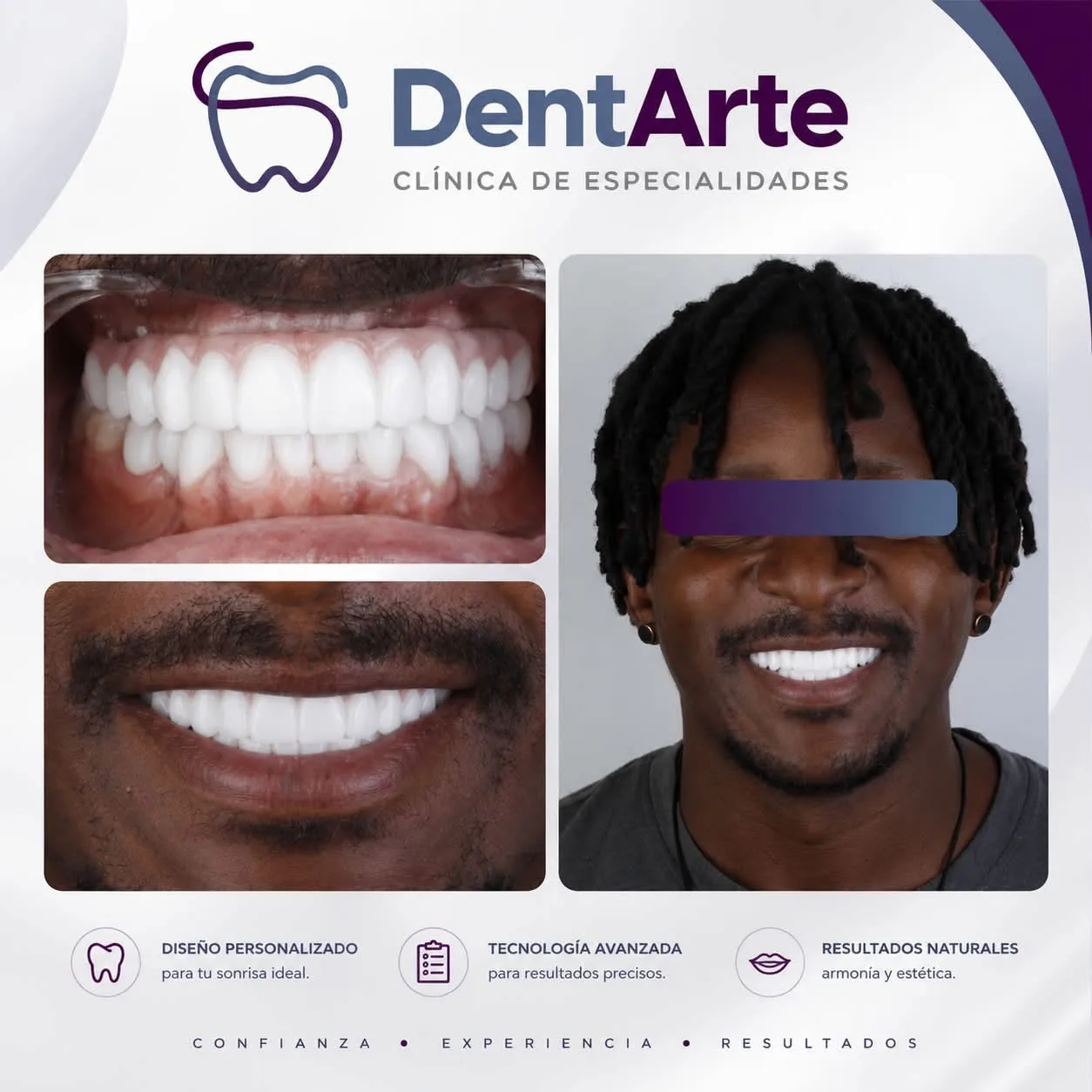 Odontología estética y diseño de sonrisa