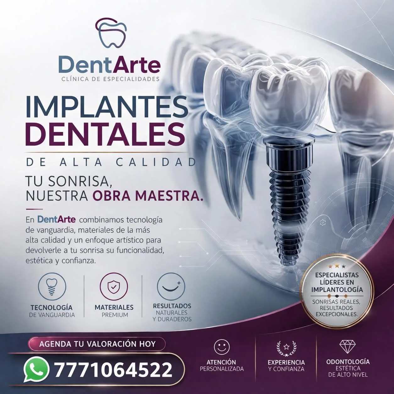 Implantes dentales